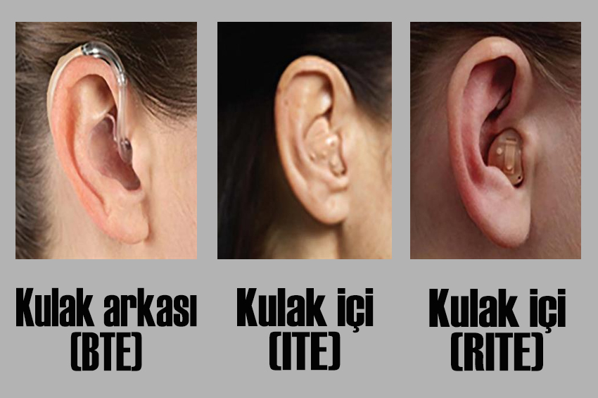İşitme Cihazı Çeşitleri ve Kimler İçin Uygundur?